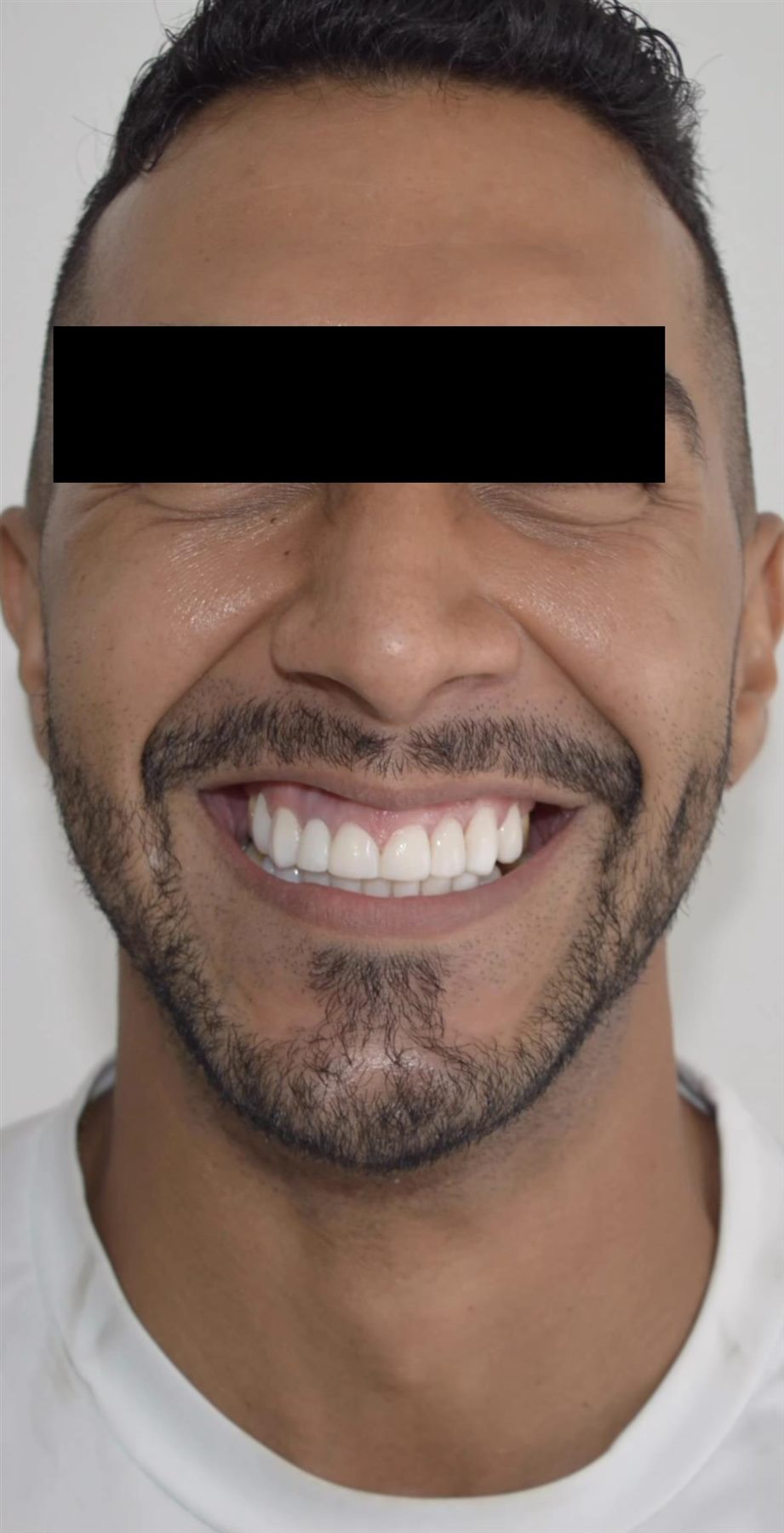 After dental success case