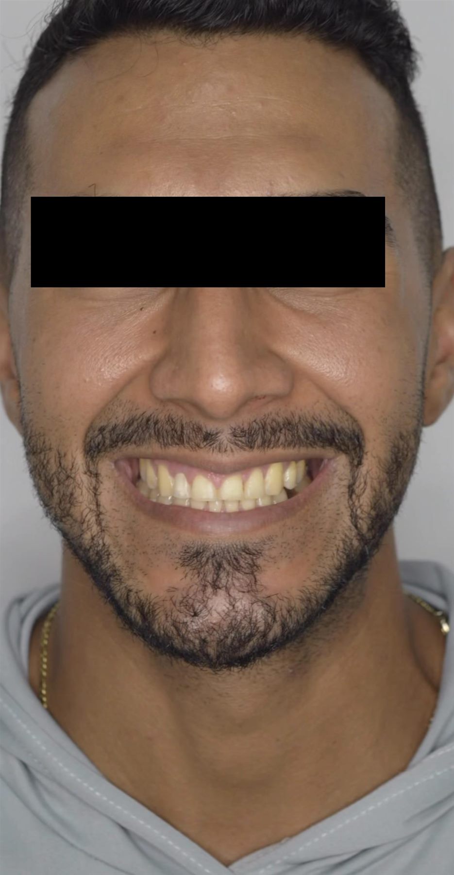 Before dental success case