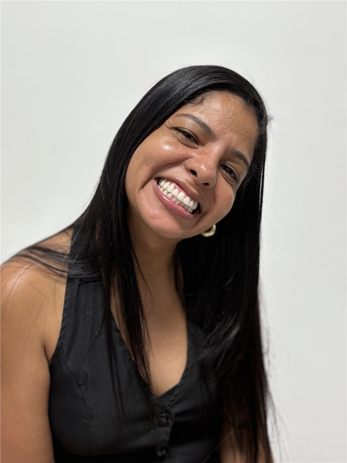 Smile design after treatment side smile